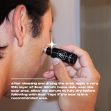 SCAR SERUM - 10ML