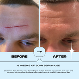 SCAR SERUM - 10ML
