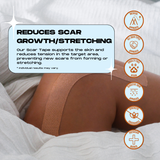 SCAR TAPE - 20PCS 10″ x 1″