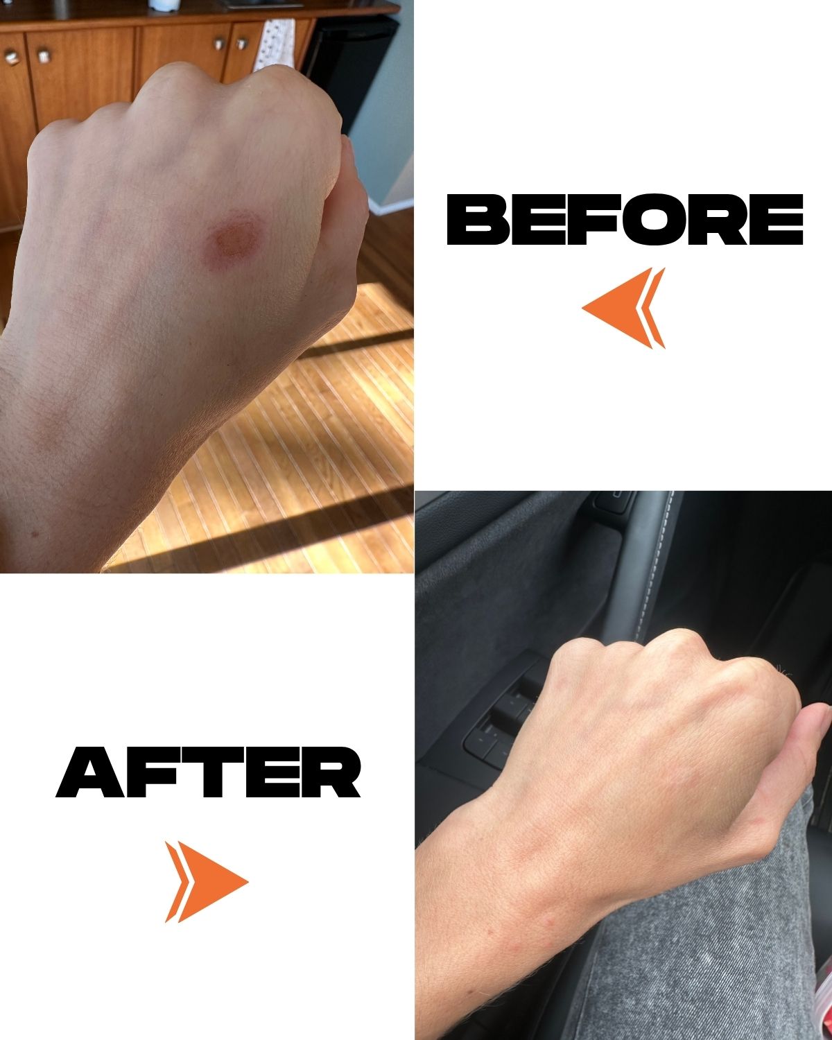 Advanced Early Scar Serum – Irritation + Antimicrobial Support