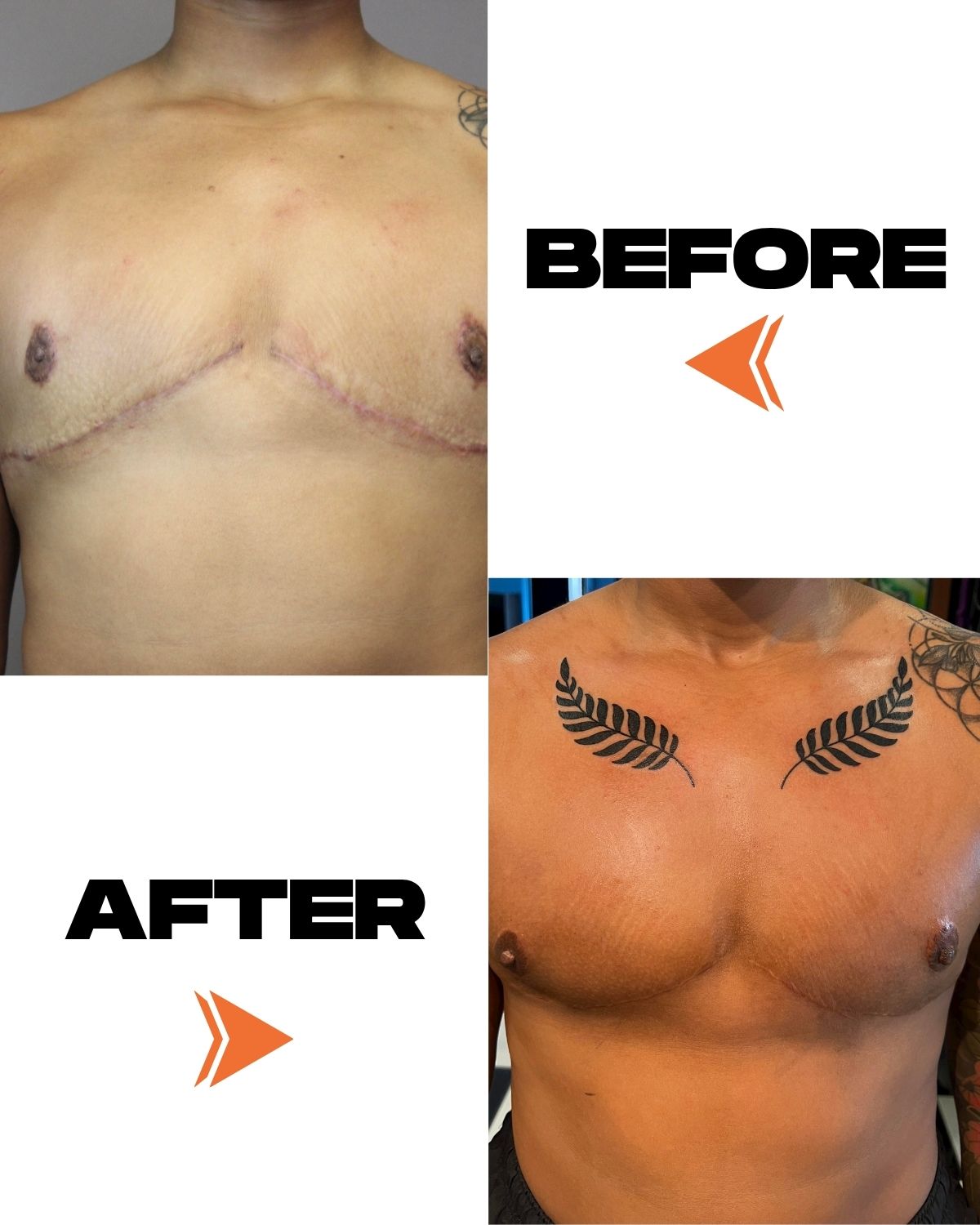 SCAR TAPE - 20PCS 10″ x 1″