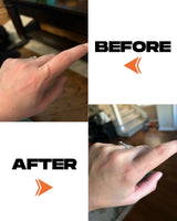 SCAR TAPE - 4PCS 6.5″ x 2″