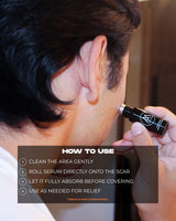 SCAR SERUM - 10ML