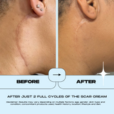 SCAR CREAM - 15ML