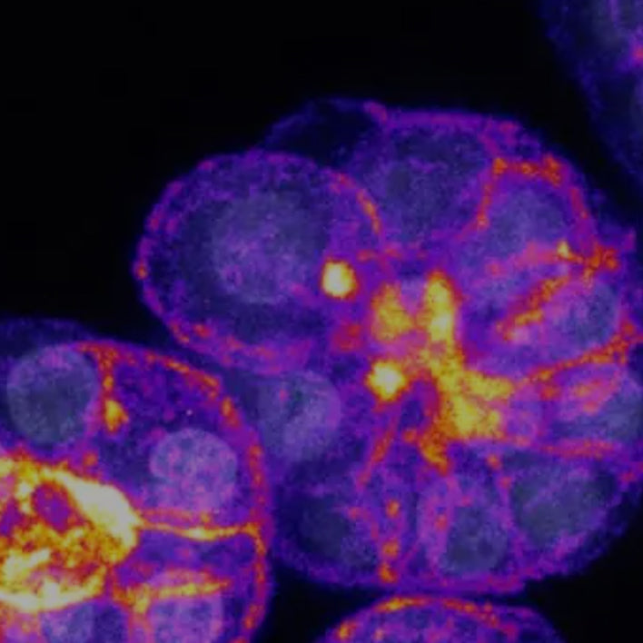 Fibrolamellar Cancer Foundation